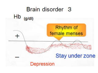 20 brain disorder 3