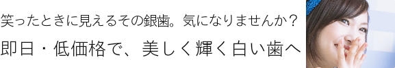 浜松市　中区　歯科　歯医者　虫歯　歯周病　笑ったときに見えるその銀歯、気になりませんか？　即日・低価格で、美しく輝く白い歯へ