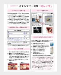 浜松市　歯科　歯医者　セレック　メタルフリー治療