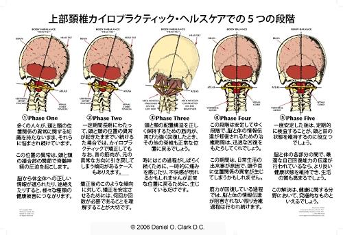上部頚椎カイロプラクティック・ヘルスケアでの５つの段階.gif